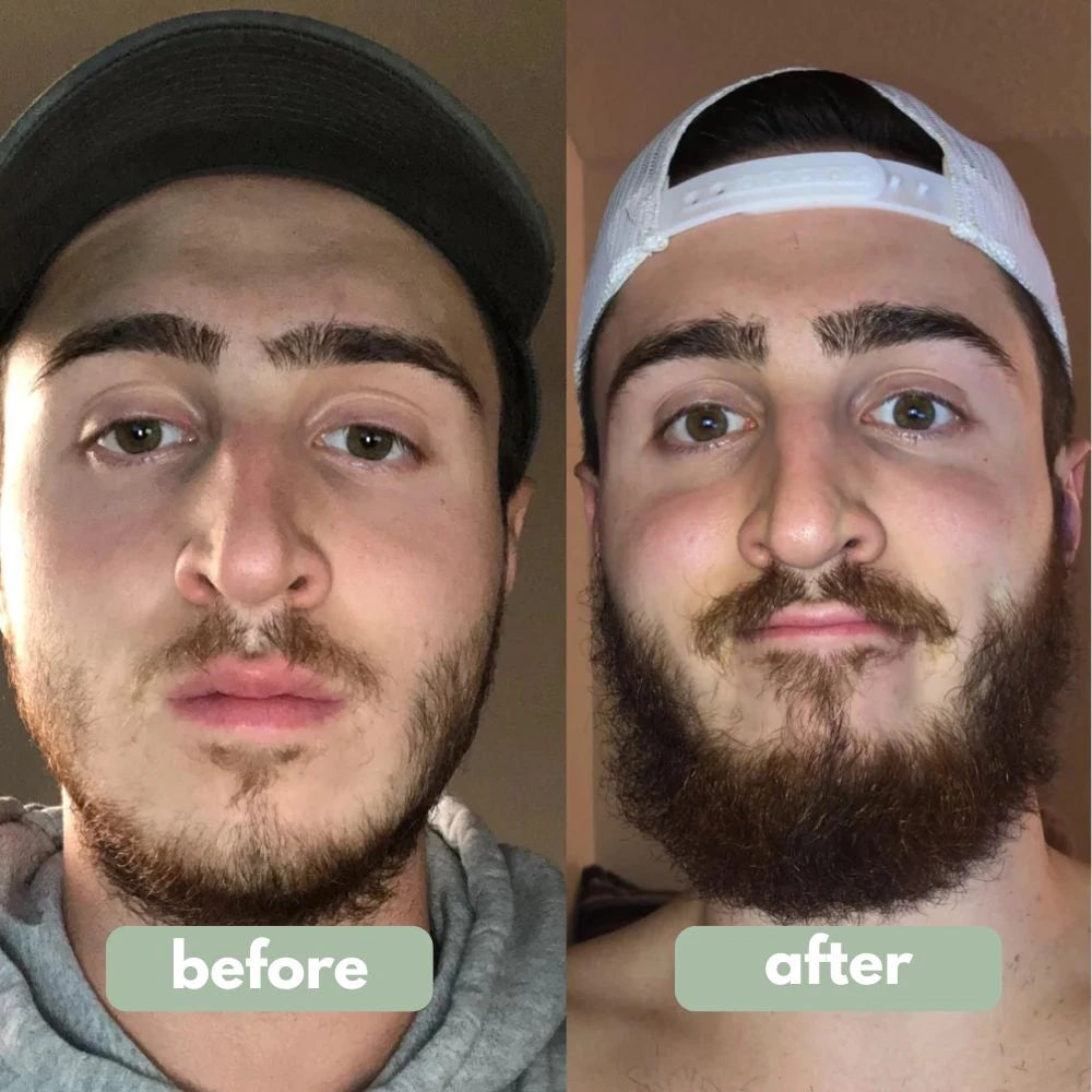 Revive™ Baardgroeiserum
