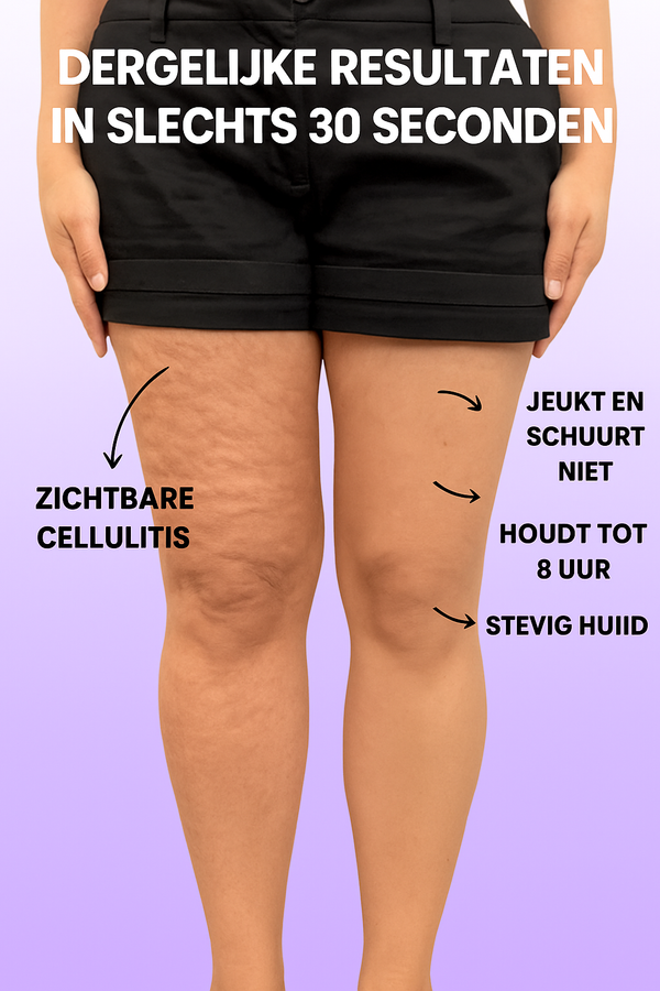 SilkLift™ - Lift Tapes voor Cellulitis