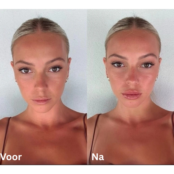 AURA™ - Extreme Lip Plumper